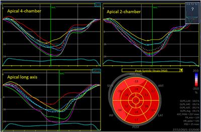 Neonatologist Performed Echocardiography for Evaluating the Newborn Infant